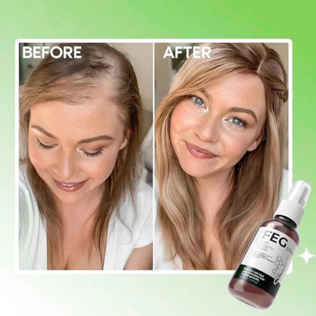 FEG Plus Hair Growth Spray (Original)